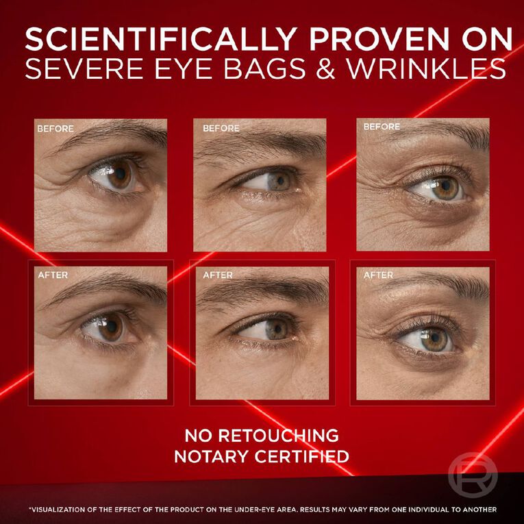 L'Oreal Paris Revitalift Laser Eye Bag Instant Eraser, , hi-res