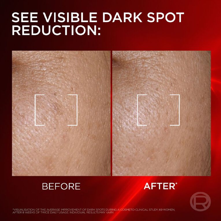 L'Oreal Paris Revitalift Laser Dark Spot Creamy-Serum, , hi-res