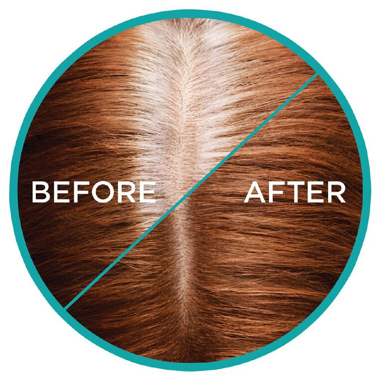 L'Oreal Paris Magic Retouch Hair Colour Auburn, , hi-res